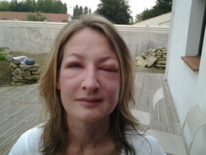 Photo de la jeune femme victime de l’attaque