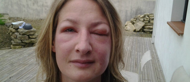 Photo de la jeune femme victime de l’attaque